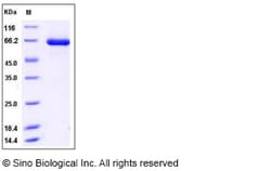 Sino Biological Human TLK2 / PKU-ALPHA Protein (aa 397-772, His & GST Tag)