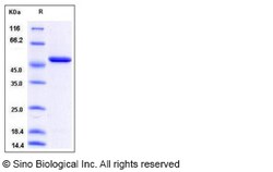 Sino Biological Human ENO1 / Enolase 1 / alpha-enolase Protein (His Tag)