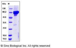 Sino Biological Recombinant Human VRK1 Protein (His & GST Tag), Quantity: