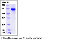 Sino Biological Recombinant Human PTPN12 Protein (aa 1-355, His & GST Tag),