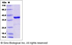 Sino Biological Recombinant Human PTPN12 Protein, Quantity: Each of 1