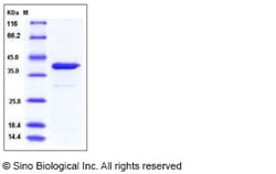 Sino Biological Recombinant Human Arginase 1/ARG1 Protein (His Tag), Quantity: