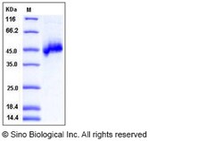 Sino Biological Human NETO1 / BTCL1 Protein (His Tag) 100ug, Quantity: