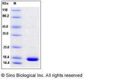 Sino Biological Recombinant Human Cystatin SN Protein (His Tag), HPLC-verified,