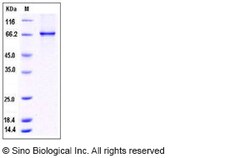 Sino Biological Human CSNK1G1 / CKI-gamma 1 Protein (His & GST Tag) 50ug,