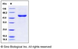 Sino Biological Human EDAR / DL Protein (Fc Tag) 100ug, Quantity: Each