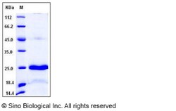 Sino Biological Recombinant Human Placental Lactogen/CSH1 Protein (His
