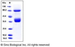 Sino Biological Recombinant Human RON/MSP receptor Protein (His Tag), HPLC-verified,