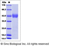 Sino Biological Human NRG1-beta 1 Protein (ECD) 1mg, Quantity: Each of