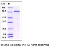 Sino Biological Recombinant Human LRRN3 Protein (His Tag), Quantity: Each