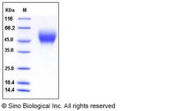 Sino Biological Recombinant Human Nectin-1/PVRL1 Protein (His Tag), Quantity: