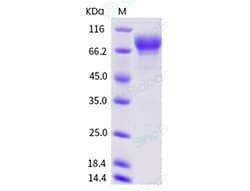 Sino Biological Human SIRP alpha Protein (ECD, Fc Tag) 50ug, Quantity: