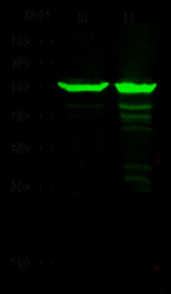Sino Biological ALDH7A1 Antibody, Rabbit MAb 100µL, Quantity: Each of 1