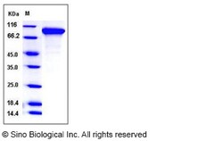 Sino Biological Human Neuroligin 1 / NLGN1 Protein (His Tag) 100ug, Quantity: