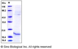 Sino Biological Human Relaxin-1 / RLN1 Protein (His Tag) 50ug, Quantity:
