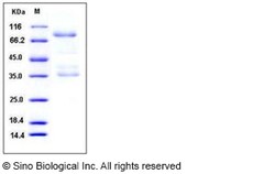 Sino Biological Recombinant Human RAGE Protein (hFc Tag), Quantity: Each