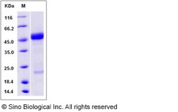Sino Biological Recombinant Human RAGE Protein, HPLC-verified, Quantity: