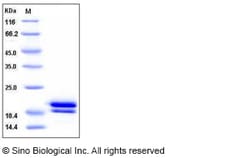 Sino Biological Recombinant Human REG1B Protein (His Tag), Quantity: Each
