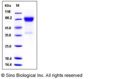 Sino Biological Recombinant Human Olfactomedin-4/OLFM4 Protein (His Tag),