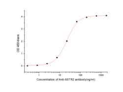 Sino Biological Human SSTR2 Protein 500ug (Sino Biological), Quantity:
