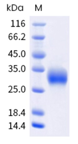 Sino Biological Human CTHRC1 Protein 100ug (Sino Biological), Quantity: