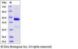 Sino Biological Human IDO1 / IDO Protein 50ug, Quantity: Each of 1