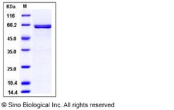 Sino Biological Recombinant Human AIM2 Protein (GST Tag), Quantity: Each