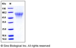 Sino Biological Human TREML2 / TLT2 Protein (His Tag) 100ug, Quantity: