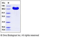 Sino Biological Recombinant Human EphA7 Protein (His Tag), HPLC-verified