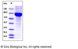 Sino Biological Recombinant Human HSP70 Protein (His Tag), Quantity: Each