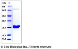 Sino Biological Human UCHL1 / PGP9.5 Protein (His Tag) 50ug, Quantity: