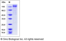 Sino Biological HIV-1 gp140 Protein (group M, subtype CRF07_BC) (His Tag),