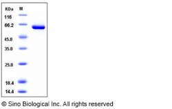 Sino Biological Recombinant Human USP7 Protein (aa 208-560, His & GST Tag),