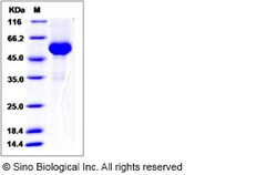 Sino Biological Human RANKL / OPGL / TNFSF11 / CD254 Protein (mFc Tag)
