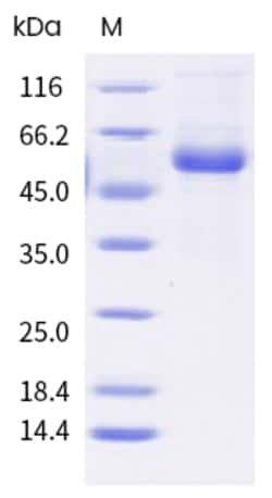 Sino Biological Human TNFSF11 Protein 100ug (Sino Biological), Quantity: