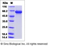 Sino Biological Influenza A H1N1 (A/Puerto Rico/8/1934) Hemagglutinin /
