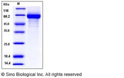 Sino Biological Influenza A H1N1 (A/Puerto Rico/8/1934) Hemagglutinin /