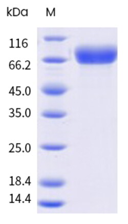 Sino Biological&nbsp;Influenza A H1N1 (A/Puerto Rico/8/1934) Hemagglutinin / HA Trimer Protein (His Tag)(MALS-verified) 100