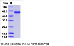 Sino Biological Influenza A H2N2 (A/Canada/720/2005) Hemagglutinin / HA