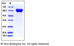 Sino Biological Influenza A H5N1 (A/Hong Kong/483/1997) Hemagglutinin /