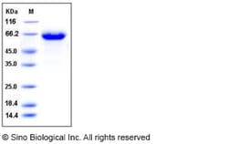 Sino Biological Influenza A H10N3 (A/duck/Hong Kong/786/1979) Hemagglutinin