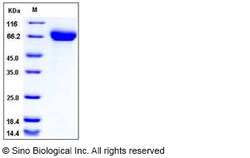 Sino Biological Influenza A H5N1 (A/Japanese white-eye/Hong Kong/1038/2006)