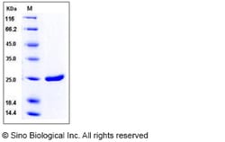 Sino Biological HIV-1 p24 Protein (group M, subtype B, strain 92418) (His