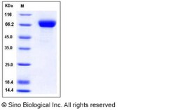 Sino Biological Influenza A H5N1 (A/duck/Hunan/795/2002) Hemagglutinin