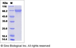 Sino Biological Influenza A H3N2 (A/Aichi/2/1968) Hemagglutinin / HA Protein