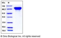 Sino Biological Influenza A H3N2 (A/Aichi/2/1968) Hemagglutinin / HA Protein