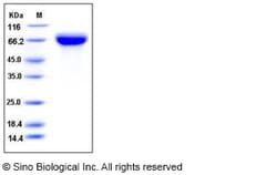 Sino Biological Influenza A H5N1 (A/whooper swan/Mongolia/244/2005) Hemagglutinin