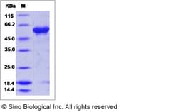 Sino Biological Influenza A H16N3 (A/black-headed gull/Sweden/5/99) Hemagglutinin