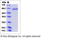 Sino Biological Influenza A H5N1 (A/chicken/India/NIV33487/06) Hemagglutinin