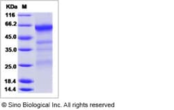 Sino Biological Influenza A H5N1 (A/Hong kong/213/2003) Hemagglutinin /